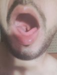 N