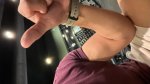 arm